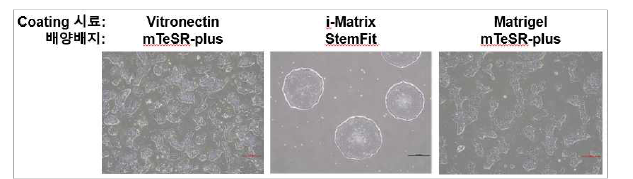 3가지 방법을 이용한 유도만능줄기세포 배양법의 확립.