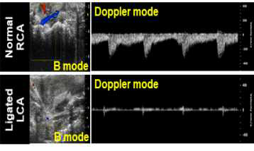 경동맥 결찰 마우스의 이상혈류를 확인한 ultrasound 분석 결과