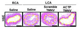 타겟팅용 나노베지클 ACTP TMNV 주입 시 정상군 Saline 그룹에 비해 신생내막이 줄어 드는 것을 보여주는 H&E images