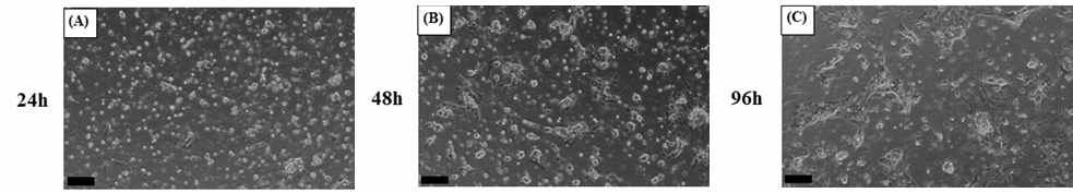 Photographs of microscopic observation of eel pituitary cell culture. The pituitary of eel was cultured for 24 (A), 48 (B) and 96 (C) hours and then photographed by a camera. Scaled bar = 100 ㎛.