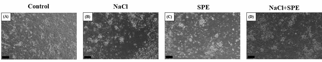 Photographs of microscopic observation of eel pituitary cell culture. The pituitary of eel was treated with control (A), NaCl (B) SPE (C) and NaCl+SPE (D) and cultured for 6 hours, and then photographed by a camera. Scaled bar = 100 ㎛.