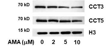 HepG2세포에서 CCT 3, 5의 발현량 변화