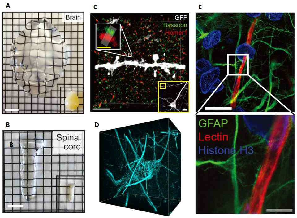 MAP (Magnified Analysis of Proteome) 을 이용한 결과들. MAP 적용 후 4배 이상 조직확대투명화가 이루어진 mouse 뇌(A) 와 척수 (B). MAP 적용 후 획득한 다양한 초고해상도 이미지들. Dentritic spine 끝에 위치한 시냅스 (C), NF-H 염색 후 확인한 fine cytoskeletal structure (D), GFAP 염색 하여 확인한 성상세포 (Astrocyte)가 혈관(Lectin) 근처에 분포하는 초고해상도 이미지 (E)