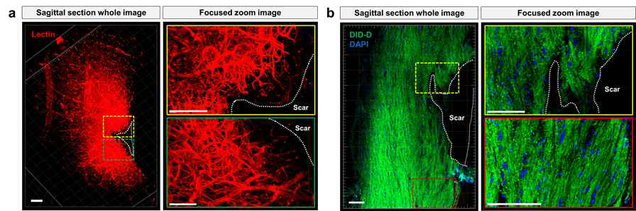MAP (Magnified Analysis of Proteome) 을 이용한 결과들. MAP 적용 후 4 배 이상 조직확대투명화가 이루어진 whole spinal 이미지 (a, b). (a) 척수 내 혈관 (Letin (Red)) 구조를 확인한 이미지, (b) DID-D (Green), DAPI (Blue)를 염색한 초고해상도 이미지들.