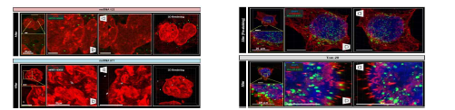 Optimized Cell-MAP을 이용한 결과들. (좌) Cell-MAP 적용 후 세포 내 miRNA-122 및 671의 초고해상도 이미지 획득 및 3D Rendering. (우) 293T cell을4배 이상 확대시켜 alpha-tubulin (Red), ARA-27-FITC (Green), DAPI (Blue) 염색한 이미지