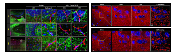 Mouse brain을 대상 으로 최적화된 조직확대투명화 기술. (좌) Mouse hippocampus 영역에 따른 Neurofilament (Green), Lectin-594 (Red), DAPI (Blue)의 초고해상도 3D 이미지, (우) alpha-tubulin 염색 후 얻은 초고해상도 3D rendering 이미지.