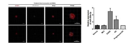 miRNA biopsy 기술을 적용하여 환자 혈액세포 내의 miRNA 이미징. (좌) PAPER-MAP 기술을 이용한 치매 환자의 말초 혈액 단핵세포의 핵 (SYTO17, Red)과 miRNA-200a-3p (White)을 고해상도 삼차원적 이미지로 분석한 결과, (우) 치매 병기에 따른 혈액 내 miRNA-200a-3p을 qPCR로 정량한 그래프.