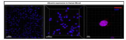 사람 혈액 내 존재하는 Albumin의 3D 이미징. 혈액 내 다량으로 존재하는 Albumin 단백질을 염색 후 삼차원적 이미지로 분석한 결과. (좌,우) Albumin (Red), DAPI (Blue) 염색 후 10배율, 20배율, 40배율로 분석한 3D 이미지.