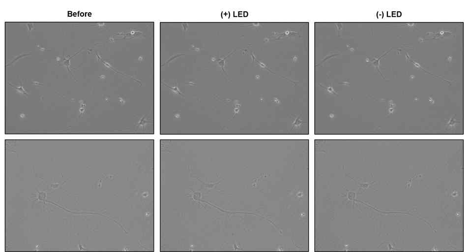 Mouse로부터 분리한 DRG 세포에 신경재생물질을 처리한 이미지.