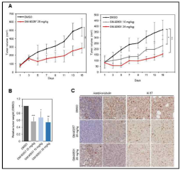 α-TAT1 inhibitor 발굴 및 이를 통한 항암 기전 규명