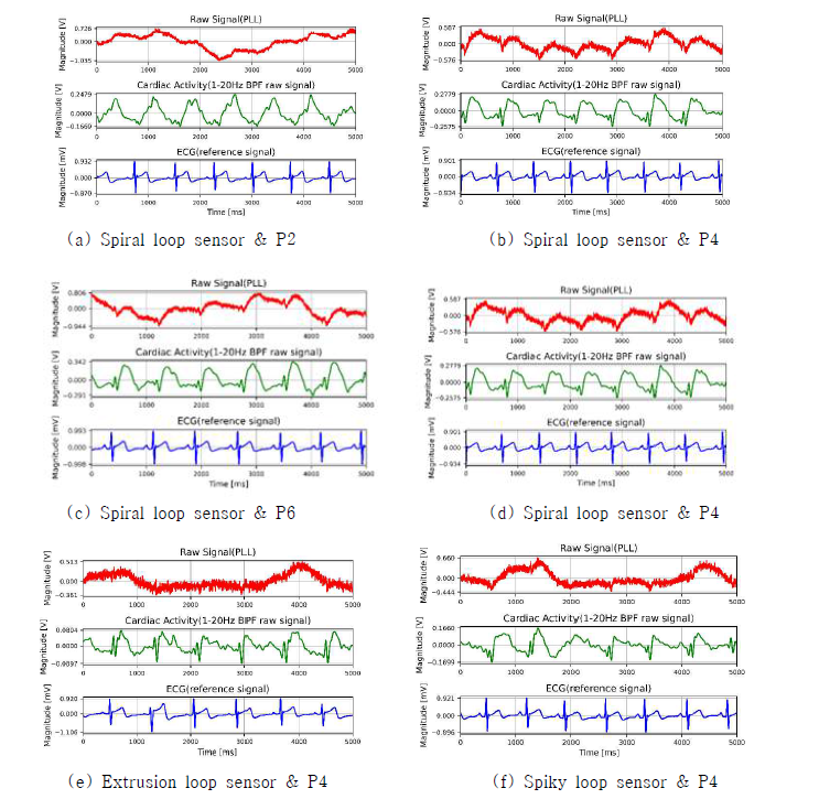 직물 루프 센서의 형상과 측정 위치에 따른 심장활동 신호