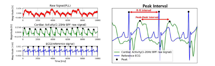 임상 심전도(ECG) 신호와 직물 루프 센서를 이용하여 측정한 심장활동 파형(R-peak, R-R interval 분석(Spiral loop sensor를 통해 P4의 위치에서 측정))