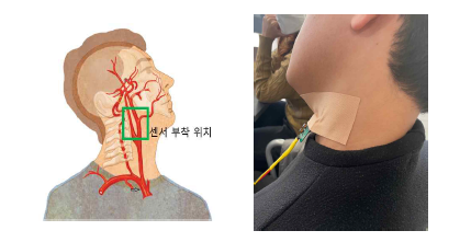 센서 부착 위치