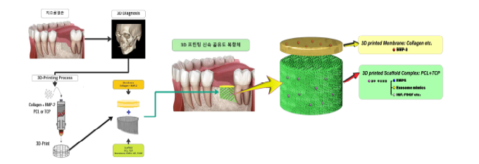 환자 맞춤형 3D 프린팅 복합체의 활용방안