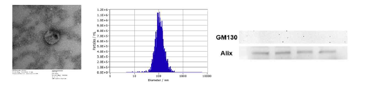 자성 비드 기반의 엑소좀 분리 결과; TEM, NTA 및 Western blot 결과