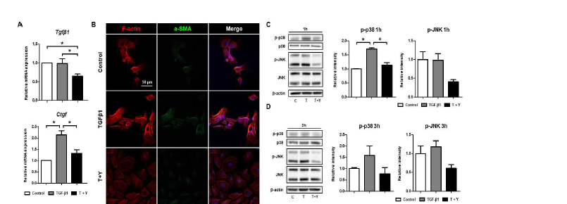 　(A) 섬유화 매개 유전자 발현 확인. (B) 섬유화 관련 단백질 발현 확인. (C, D) TGF-β1, Y-27632를 1 시간 혹은 3 시간 동안 처리한 그룹에서 TGF-β 신호경로 하위 단백질 (p38, JNK)의 활성화 수준 확인. p *< 0.05.