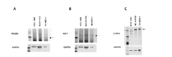 폐편평상피세포암 cancer cell line에서 PIK3R5, RAF1, CCNA2발현.