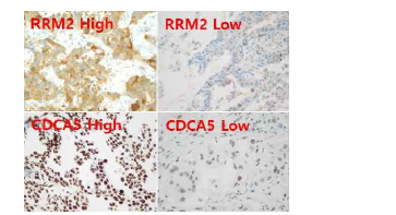 RRM2, CDCA5의 단백질 발현.