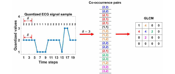 양자화된 심전도 신호에서 GLCM 생성하는 과정