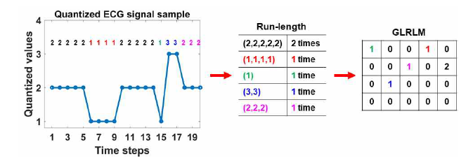 양자화된 심전도 신호에서 GLRLM 생성하는 과정