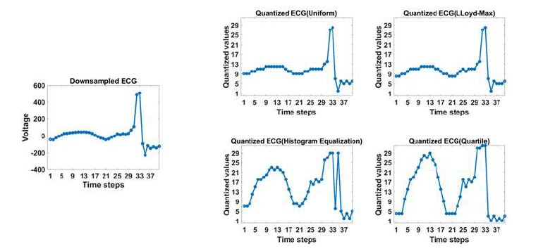 심전도 신호(왼쪽)와 4가지 방법으로 양자화한 심전도 신호(오른쪽)