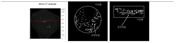 조직모듈의 안정적인 포지셔닝 평가를 위한 Micro-CT 분석