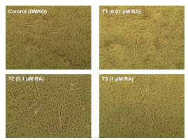 Representative photographs showing May-Giemsa stained 6 days differentiated SV cells that were treated with different levels of RA treatment during the differentiation stage (40X). SV cells were treated with control: DMSO, T1: 0.01 μM RA, T2: 0.1 μM RA, T3: 1 μM RA