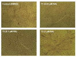 Representative photographs showing May-Giemsa stained 6 days differentiated SV cells that were treated with different levels of RA treatment during the growth stage (40X). SV cells were treated with control: DMSO, T1: 0.01 μM RA, T2: 0.1 μM RA, T3: 1 μM RA