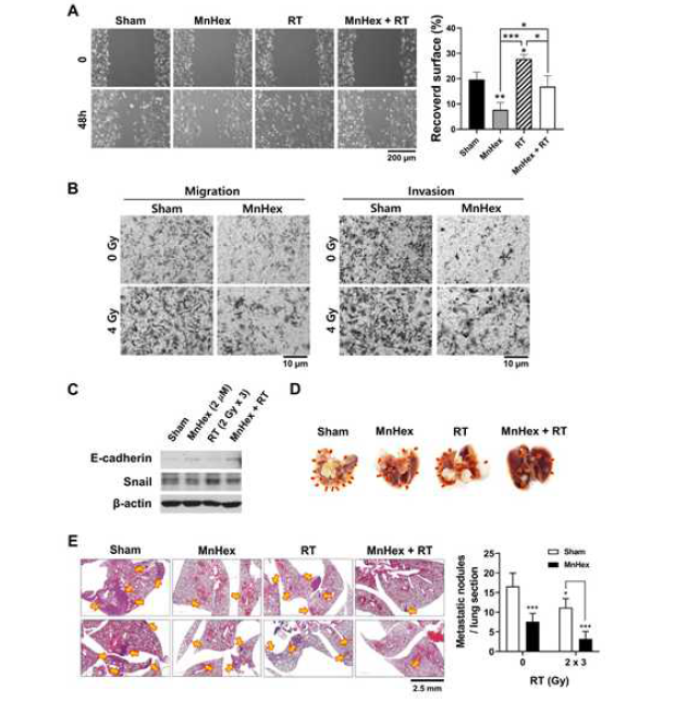 MnHex와 방사선 병행치료에 의한 전의억제 및 EMT 변화 효과