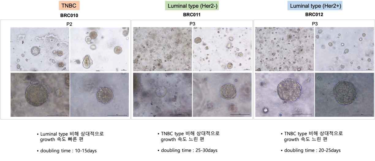 유방암 오가노이드 제작 사진