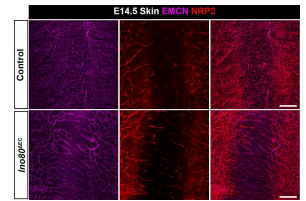 면역형광염색법으로 확인한 피부에서의 Ino80 결손 내피세포 발달 양상
