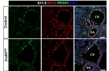 E11.5 생쥐의 cardinal vein 부분 sectioning ERG1 및 PROX1 면역형광염색