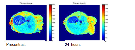 7.0T 동물용 MRI로 촬영한 유전자 예광탄이 전달됨 LLC 종양 모델 마우스의 gadoxetic acid enhanced MRI 영상의 T1 mapping 영상.