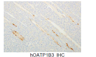 유전자 예광탄이 전달됨 LLC 종양 조직의 hOATP1B3 면역화학염색 소견.