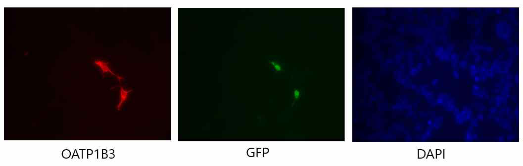 CMV-OATP1B3-IRES-GFP DNA를 초음파 조영제 기법으로 in vitro 유전자 형질주입 을 시행하였으며, 세포 고정 후 OATP1B3 및 DAPI 면역형광염색만 시행하여 OATP1B3 단백질 의 합성을 확인하였음. GFP는 별도의 면역형광 염색없이 세포 자체적으로 합성한 GFP 신호를 검 출하였음.