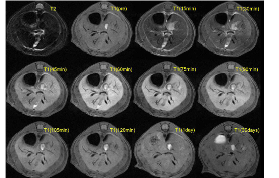7.0T 동물용 MRI에서 수립한 gadoxetic acid enhanced MRI에 사용할 T1WI with fat suppression의 프로토콜 테스트 영상