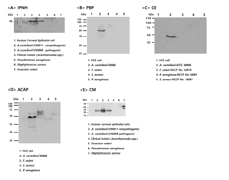 Western blot 기법으로 확인된 가시아메바 항체들(A~E)의 반응 특이성