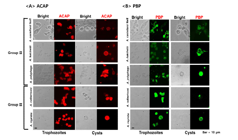 Immunocytochemistry 기법을 통해 5종류의 가시아메바에 대한 ACAP 및 PBP 항체의 특이적 반응 확인