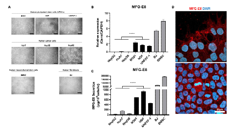 인간 전능성 줄기세포의 MFG-e8 분비 양상 분석