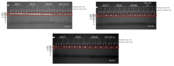 삼중음성 유방암 세포주에서 Decitabine과 Zebularine 처리 후 MHC class-I (HLA-A, HLA-B, HLA-C) 유전자의 메틸화 양상