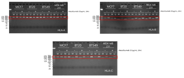 삼중음성 유방암 세포주에서 면역관문억제제 (Atezolizumab) 처리 후 MHC class-I (HLA-A, HLA-B, HLA-C) 유전자의 메틸화 양상