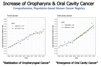한국 두경부암의 변화: 편도암의 안정적 증가와 구강암 증가의 가속화