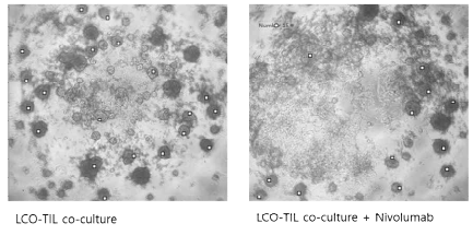 폐암 오가노이드와 TIL의 공배양 결과. 왼쪽 그림은 Nivolumab을 처리하지 않은 군이며 오른쪽 그림은 Ninolumab을 처리한 결과