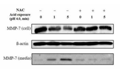 NAC에 의한 MMP7 배출 억제