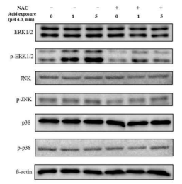 산처리 관련 MAPKs 기전