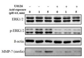 ERK 억제에 의한 MMP7 배출 조절