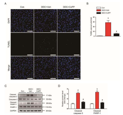 DDC 모델에서 CoPP의 anti-apoptotic effect