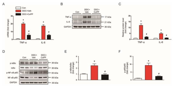 DDC 모델에서 CoPP에 의한 cytokine 감소 및 NF-kB 억제