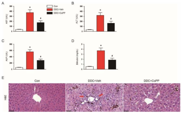 DDC 모델에서 CoPP의 간기능 및 조직학적 손상 개선 효과