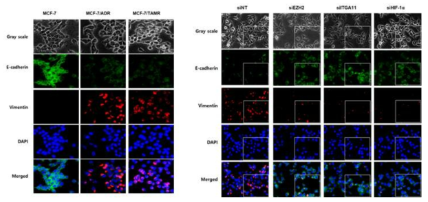 인테그린 α11 또는 EZH2를 침묵이 약물 저항성 유방암세포의 EMT 관련 유전자 발현에 미치는 영향